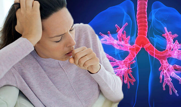 A Holistic Integrative Approach to Chronic Cough