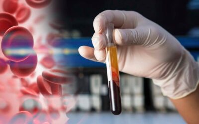 PRP vs PRF – What is the Difference?