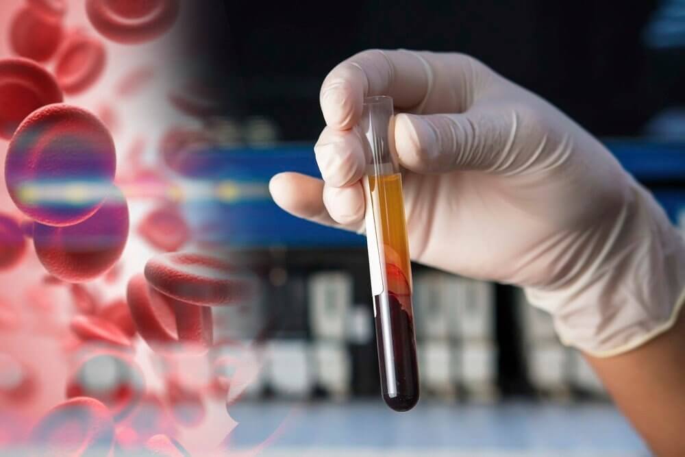 PRP vs PRF – What is the Difference?