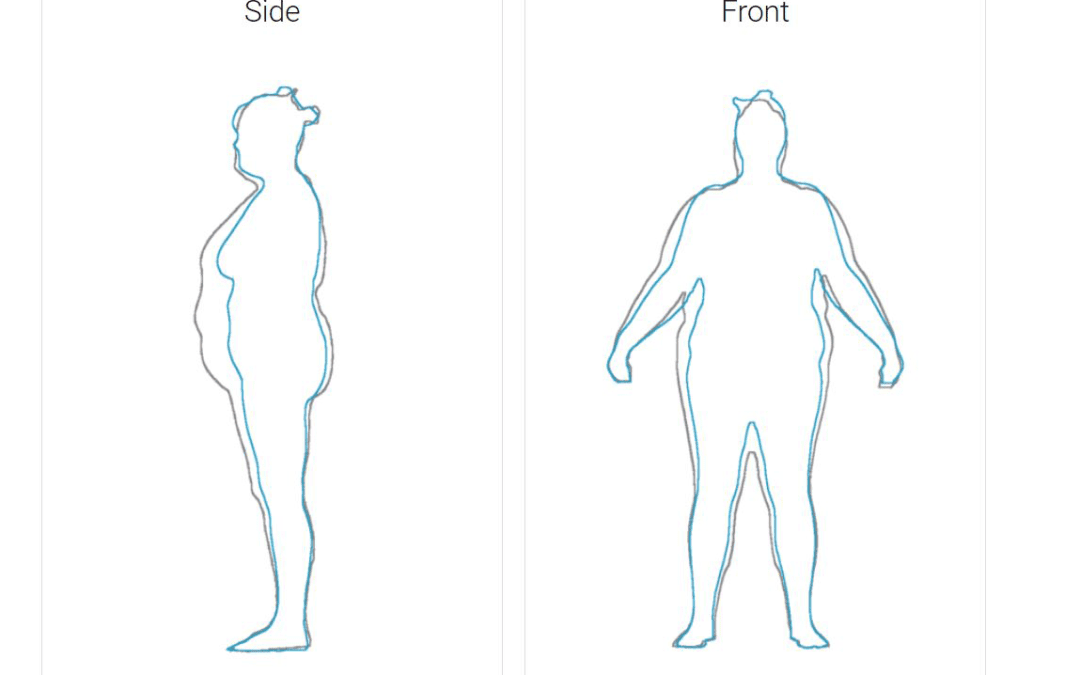 What Are The Different Types Of Body Scans?