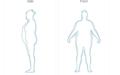 What Are The Different Types Of Body Scans?