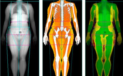 Where Can I Get A DEXA Scan For Body Fat?
