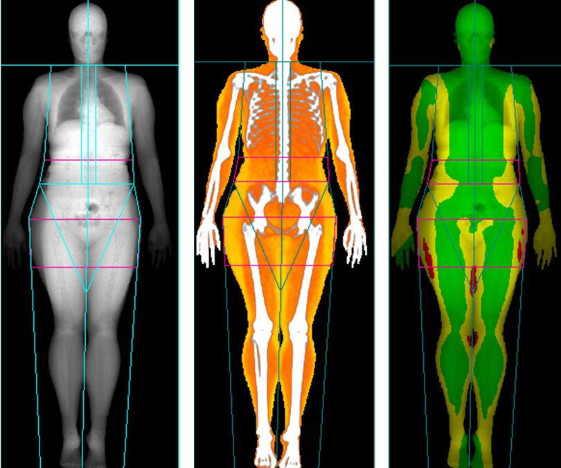Where Can I Get A DEXA Scan For Body Fat?
