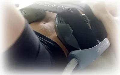 Is Emsculpt NEO Worth It?