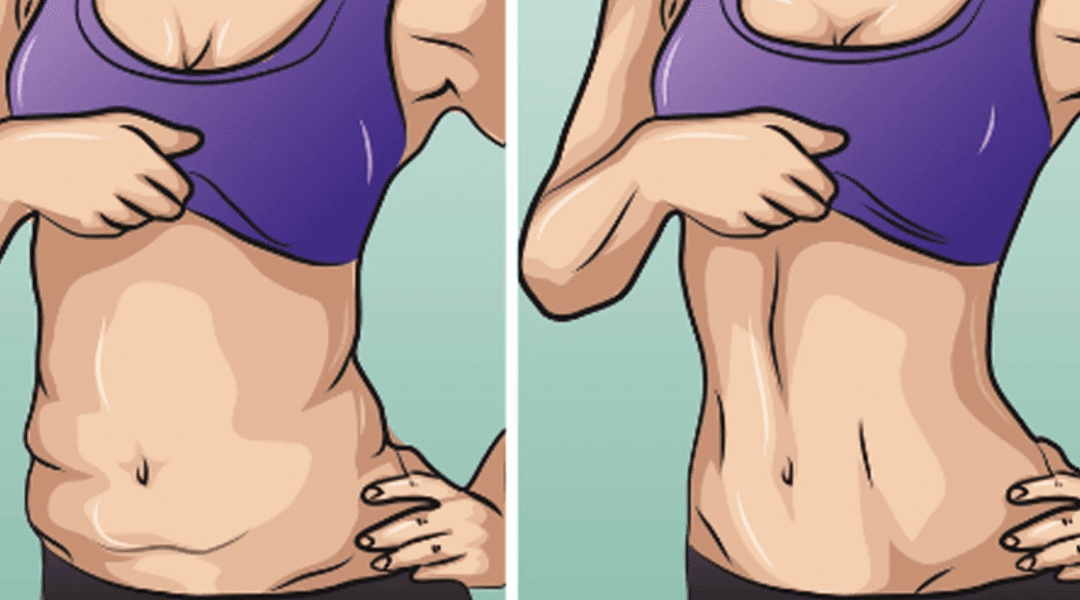 Can You Actually Tighten Loose Skin After Weight Loss?