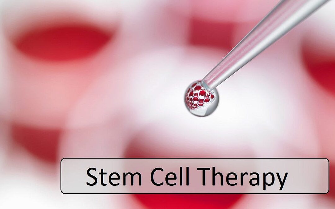 How Does Stem Cell Therapy Work